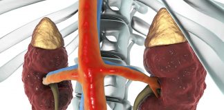 A prishet agjërimi nga pastrimi i veshkëve?