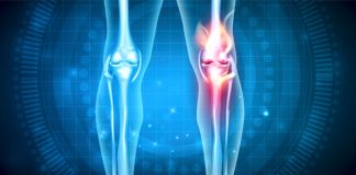 Në ëndërr kam parë se më është thyer këmba