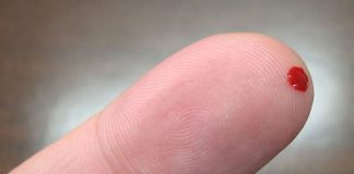 Larja me gjak për të shëruar sëmundjet