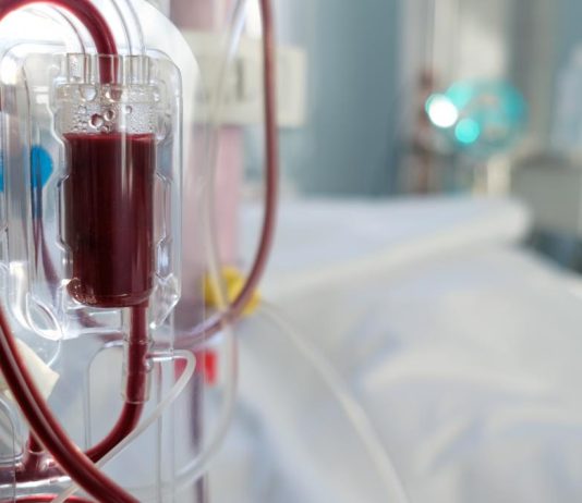 A lejohet bashkimi i namazeve gjatë përdorimit të aparatit të dializës që mund të zgjasë shumë?