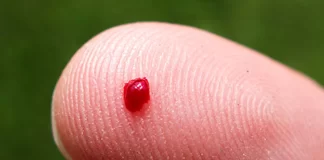 A i prishet agjërimi nëse i sëmuri ka gjakderdhje?