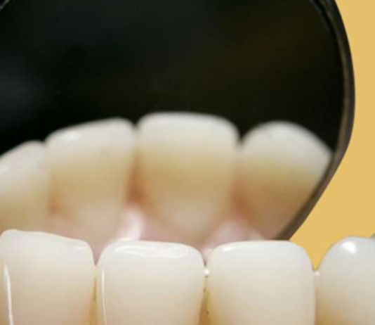 A e prish abdesin dalja e gjakut nga dhëmbët?