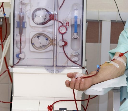 Si ta kompensojë agjërimin i sëmuari me dializë?