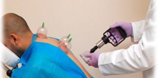 Cilat janë ditët (sipas haditheve) kur preferohet bërja e hixhames?