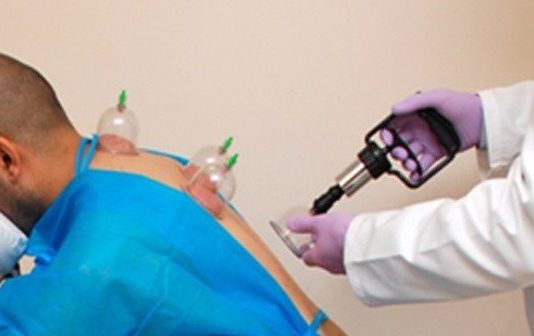 Cilat janë ditët (sipas haditheve) kur preferohet bërja e hixhames?