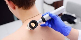 A lejohet të kryejmë ndërhyrje kirurgjikale për heqjen e shenjës nga fytyra?