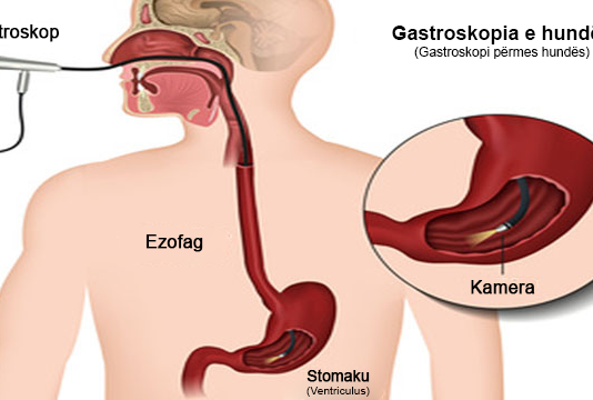 A e prish agjërimin Gastroskopia (ekzaminimi i stomakut përmes endoskopit)?