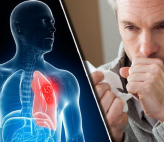 Çfarë ndodhë me ata që vdesin nga kanceri: Shkojnë në xhenet apo xhehnem?