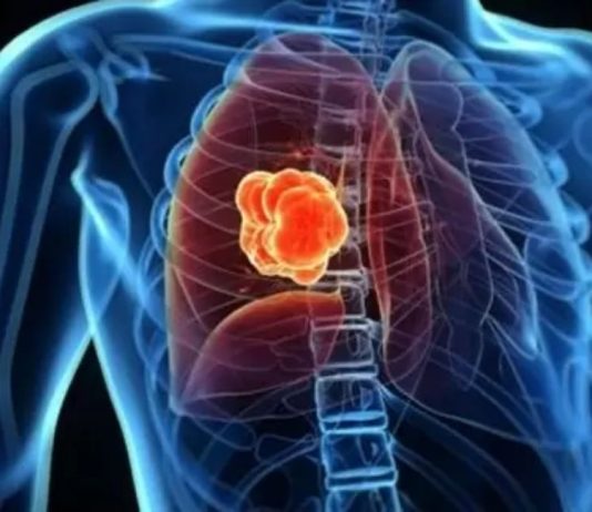 A i tregohet të sëmurit me kancer për sëmundjen që ka?