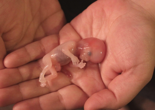 A i falet namazi i xhenazes një fëmije të abortuar?!