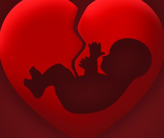 A lejohet aborti me qëllim që t’i shpëtohet jeta nënës?