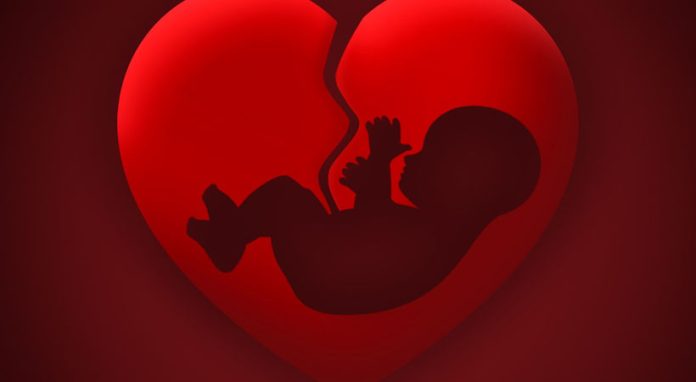 1703_9602_62aea3ce2f