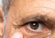 Dispozita fetare mbi mbushjen e rrudhave me “Filler” dhe injeksionet estetike