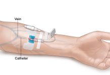 Gjykimi i Injeksioneve Intramuskulare dhe Intravenoze (jo ushyqese të cilat janë për luftimin e sëmundjeve) për agjëruesin?!