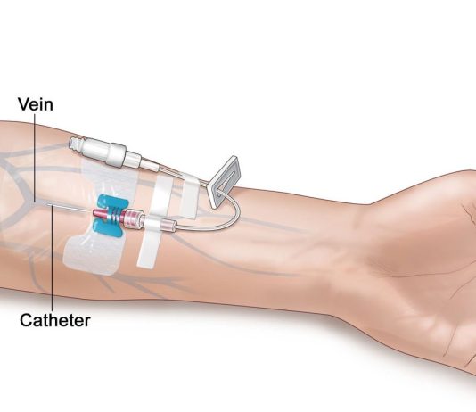 Gjykimi i Injeksioneve Intramuskulare dhe Intravenoze (jo ushyqese të cilat janë për luftimin e sëmundjeve) për agjëruesin?!