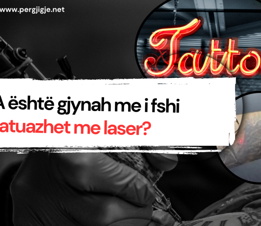 A është gjynah me i fshi tatuazhet me laser?
