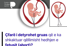 Çfarë i detyrohet gruas që e ka shkaktuar qëllimisht hedhjen e fetusit (abort)?